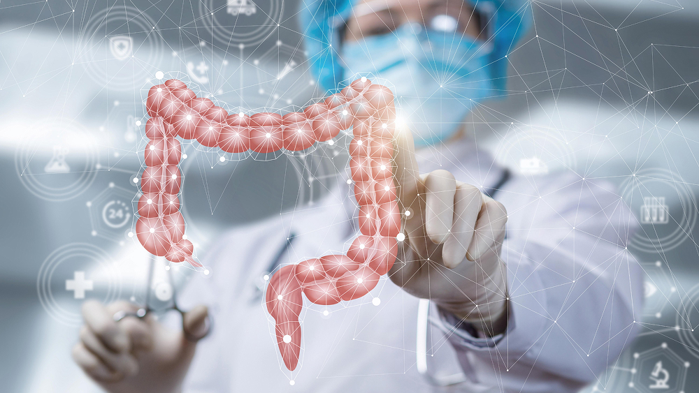 Minimally Invasive Colon-Cancer Surgery: What Patients Should Expect Before and After