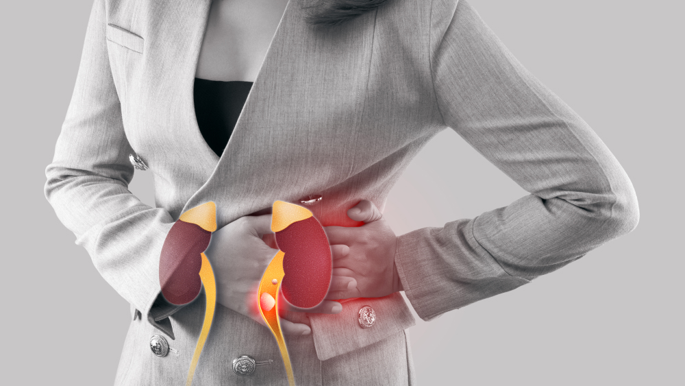 Laparoscopic Surgery for Urinary Stones: A Minimally Invasive Solution